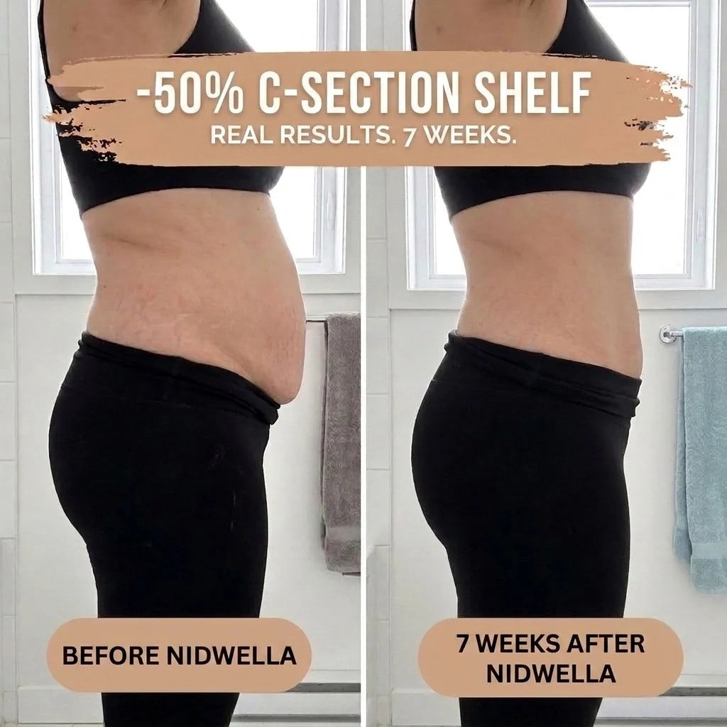 Postpartum Shaping Knickers — real results 7 weeks